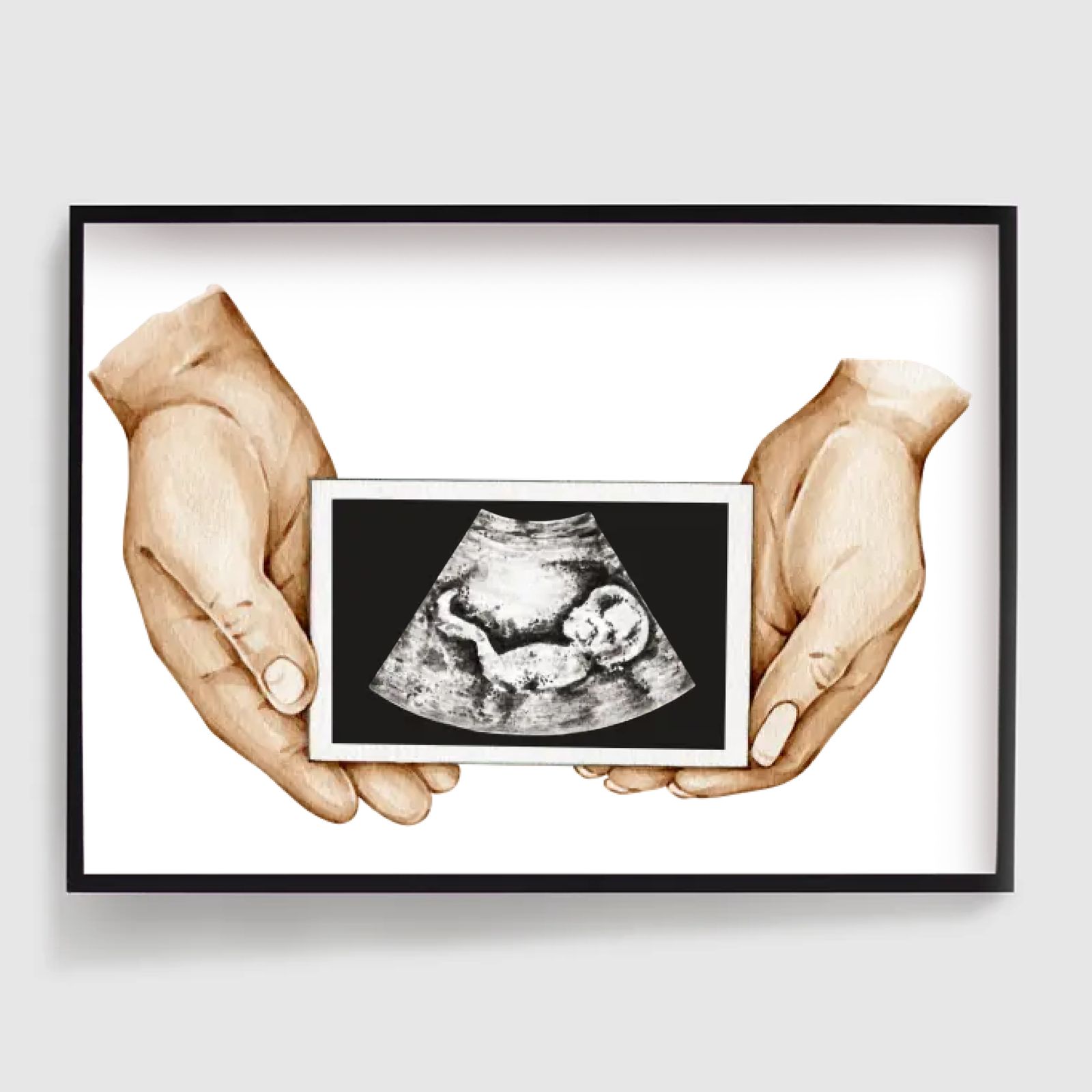 Personlig Affisch - Händer som Håller Sonogram